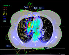 Apollo Specialty Hospital, Apollo Specialty Cancer Hospital